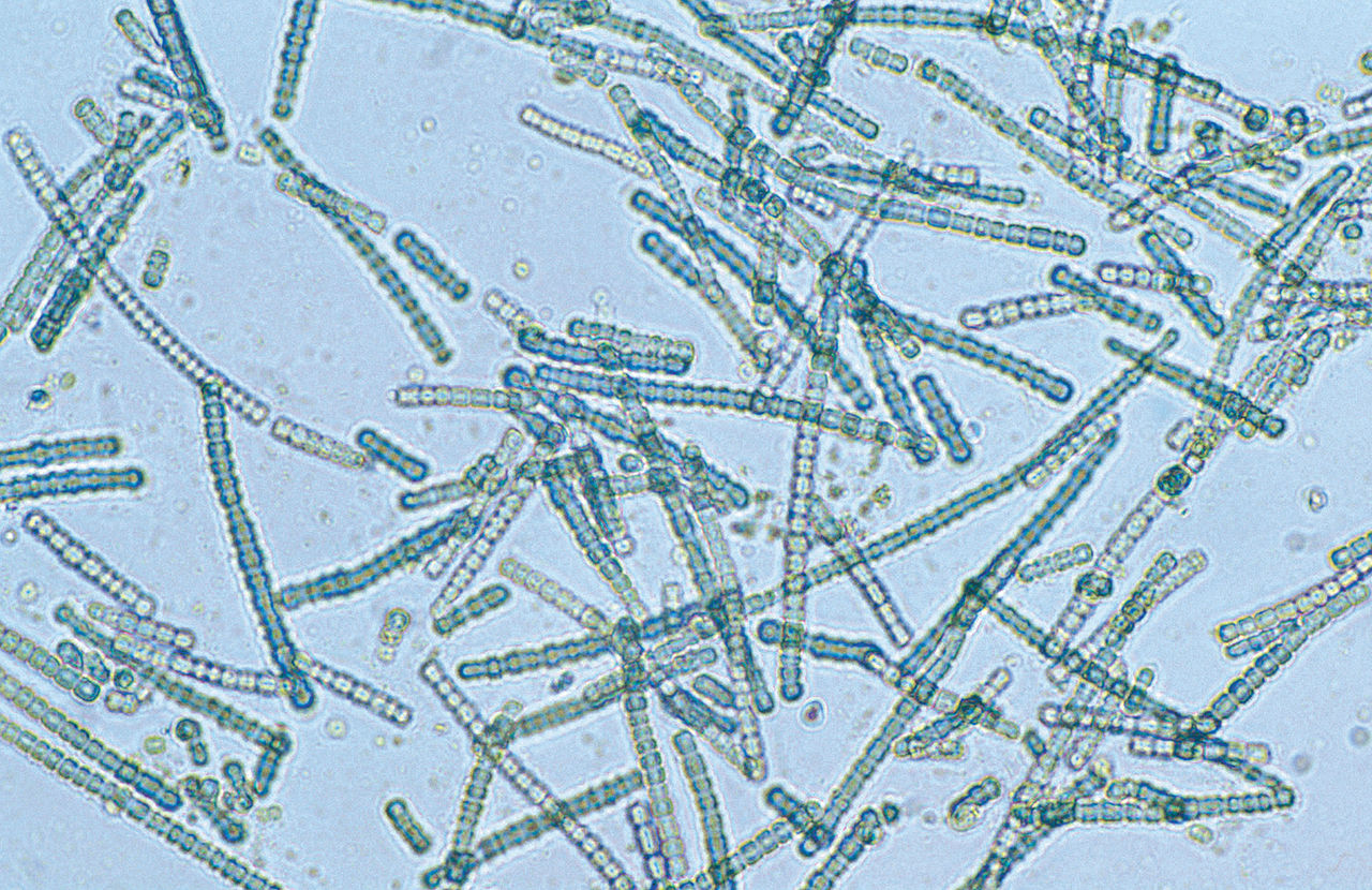 blue green algae microphotograph